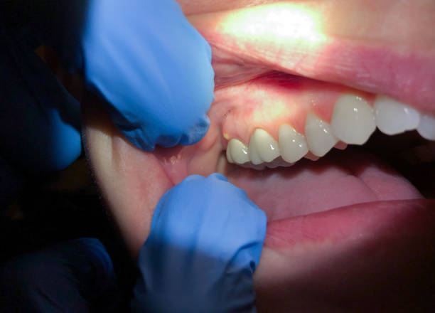 Best Walk-In Emergency Dental Services in Sully Square, VA